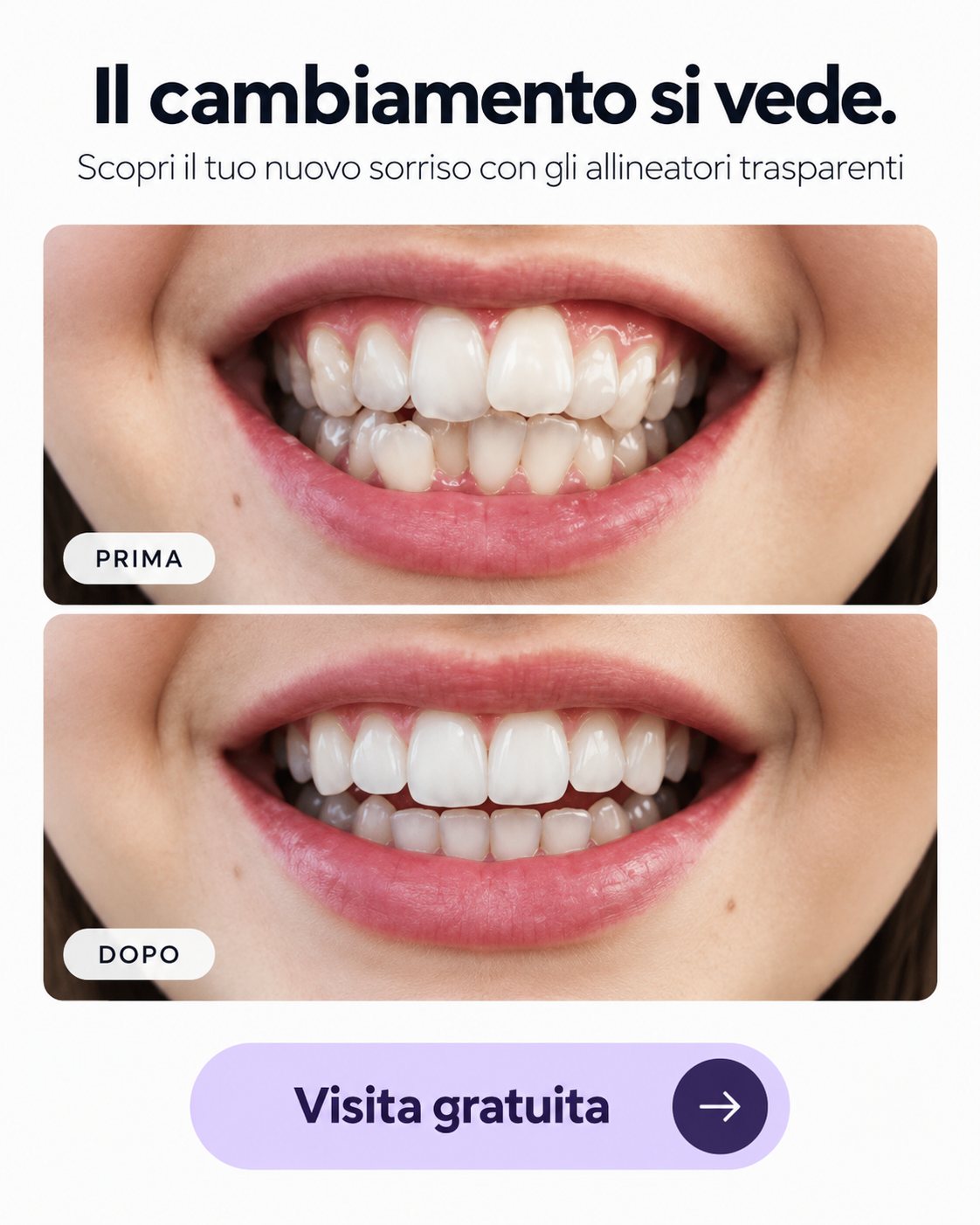 Posti limitati questo mese